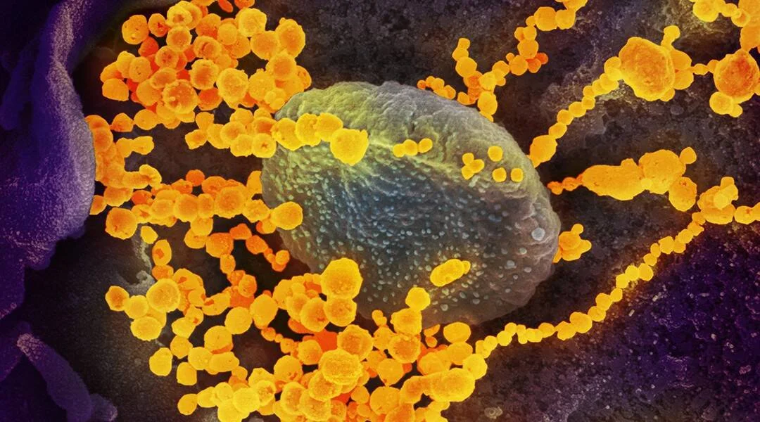 Micrografía electrónica coloreada muestra partículas del SARS-CoV-2 en naranja rodeando una célula huésped en verde.