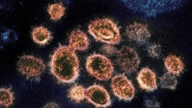 Imagen de microscopio electrónico coloreada que muestra múltiples partículas esféricas del coronavirus SARS-CoV-2 en naranja y verde sobre fondo oscuro.
