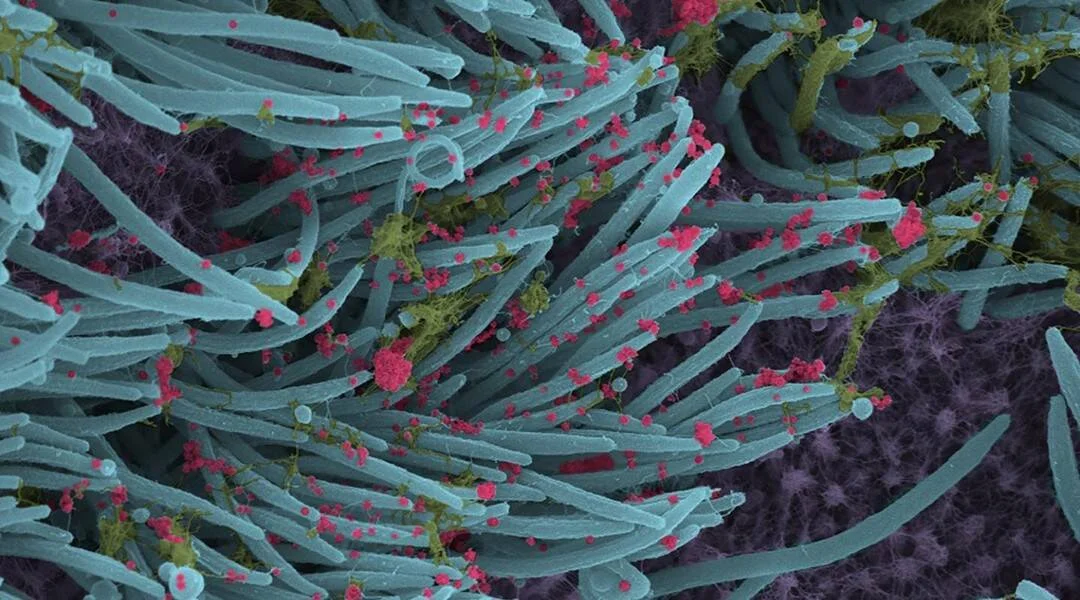 Imagen de microscopía electrónica coloreada muestra partículas virales rojas sobre cilios celulares azules y tejido púrpura.