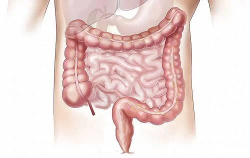 Ilustración médica del sistema digestivo mostrando el intestino delgado y grueso en el abdomen humano.