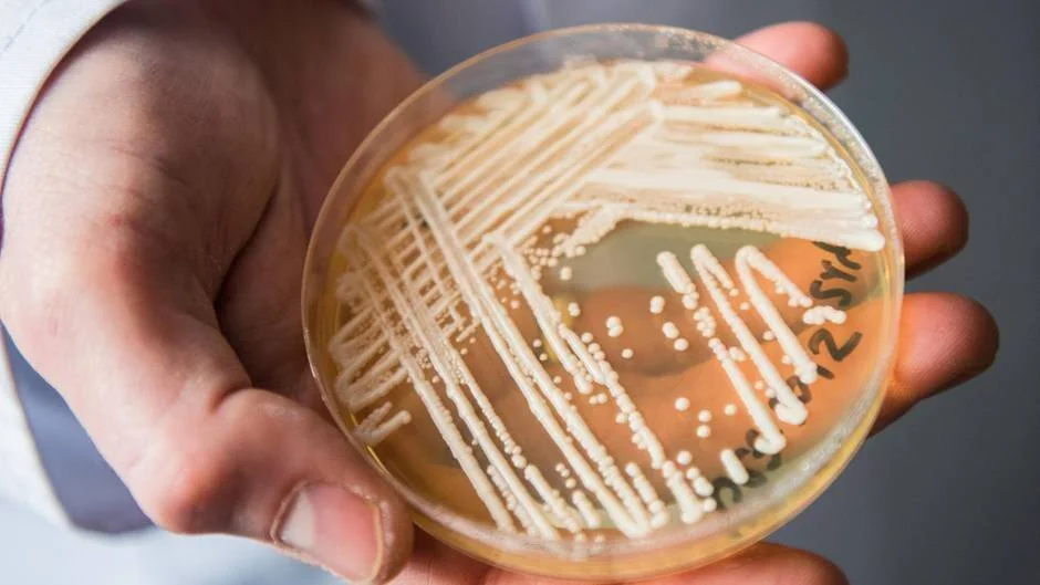 Mano sosteniendo una placa de Petri con colonias de bacterias o hongos cultivadas en medio de agar.