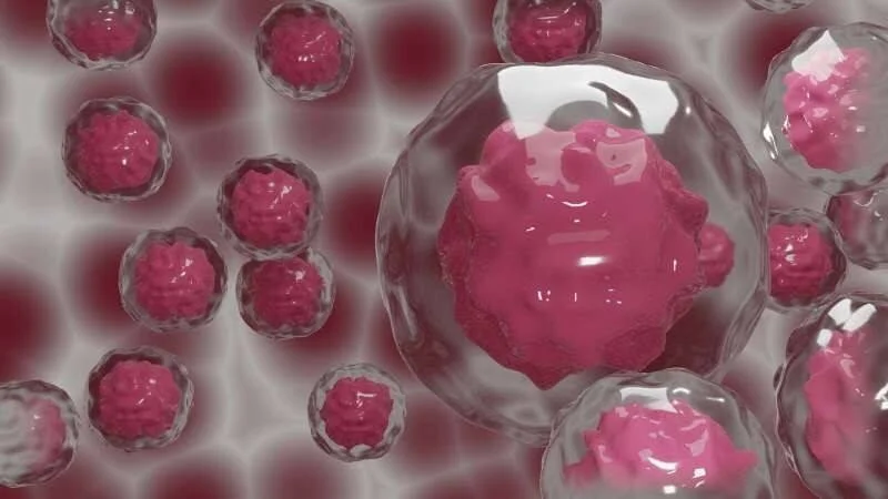 Representación tridimensional de células cancerosas de color rosa dentro de membranas transparentes esféricas.