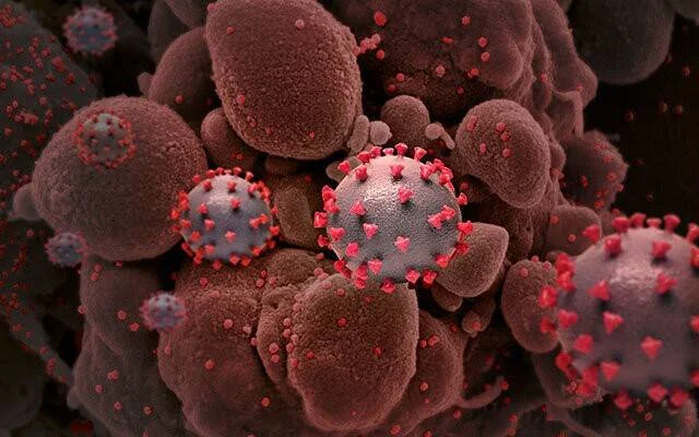 Ilustración microscópica de partículas del virus SARS-CoV-2 con espículas rojas rodeando células infectadas.