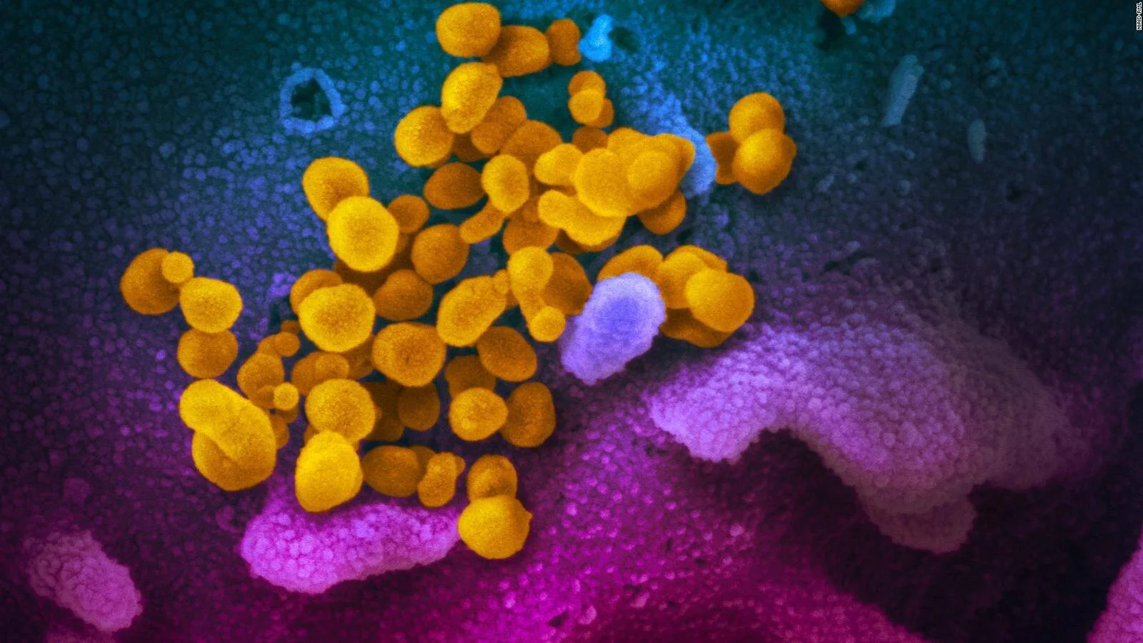 Imagen de microscopio electrónico coloreada que muestra partículas virales en amarillo sobre una superficie celular en tonos rosa y azul.
