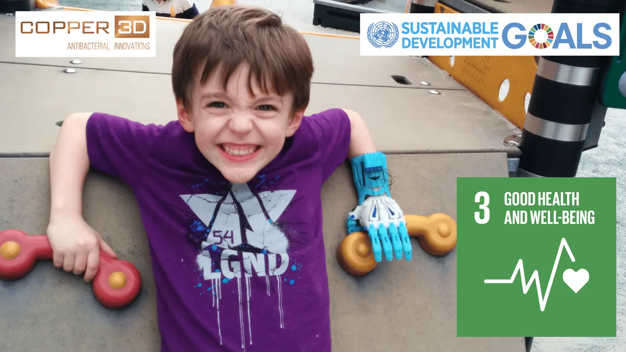 Niño sonriente con una prótesis de mano impresa en 3D azul y blanca, junto a logos de Copper 3D y ODS 3 de la ONU.