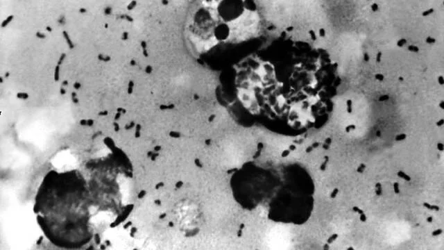 Micrografía en blanco y negro que muestra bacterias Yersinia pestis rodeando células fagocíticas, agente causante de la peste bubónica.