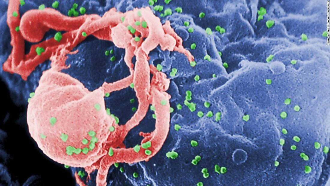Micrografía electrónica coloreada muestra partículas del virus VIH (puntos verdes) brotando de una célula linfocítica infectada (rosa y azul).