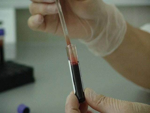 Manos con guantes de látex transfieren sangre con una pipeta a un tubo de ensayo en un laboratorio clínico.