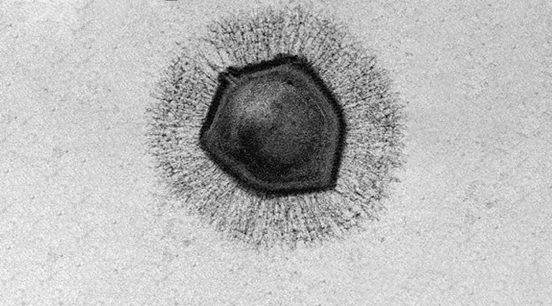 Micrografía electrónica en blanco y negro de una partícula viral con cápside hexagonal y proyecciones radiantes en su superficie.