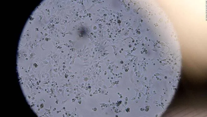 Vista microscópica de células dispersas sobre una superficie, observadas a través del ocular circular de un microscopio óptico.