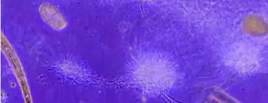 Vista microscópica con fondo azul-violeta que muestra microorganismos ovales amarillos y formaciones cristalinas blancas estrelladas.