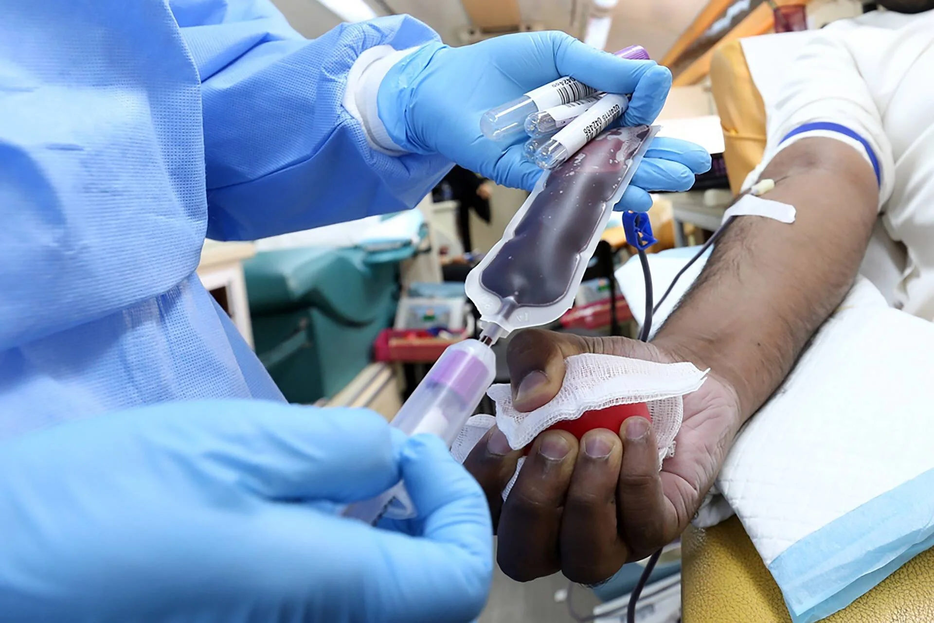 Profesional de salud con guantes azules conecta una bolsa de sangre al brazo de un donante durante una extracción sanguínea.