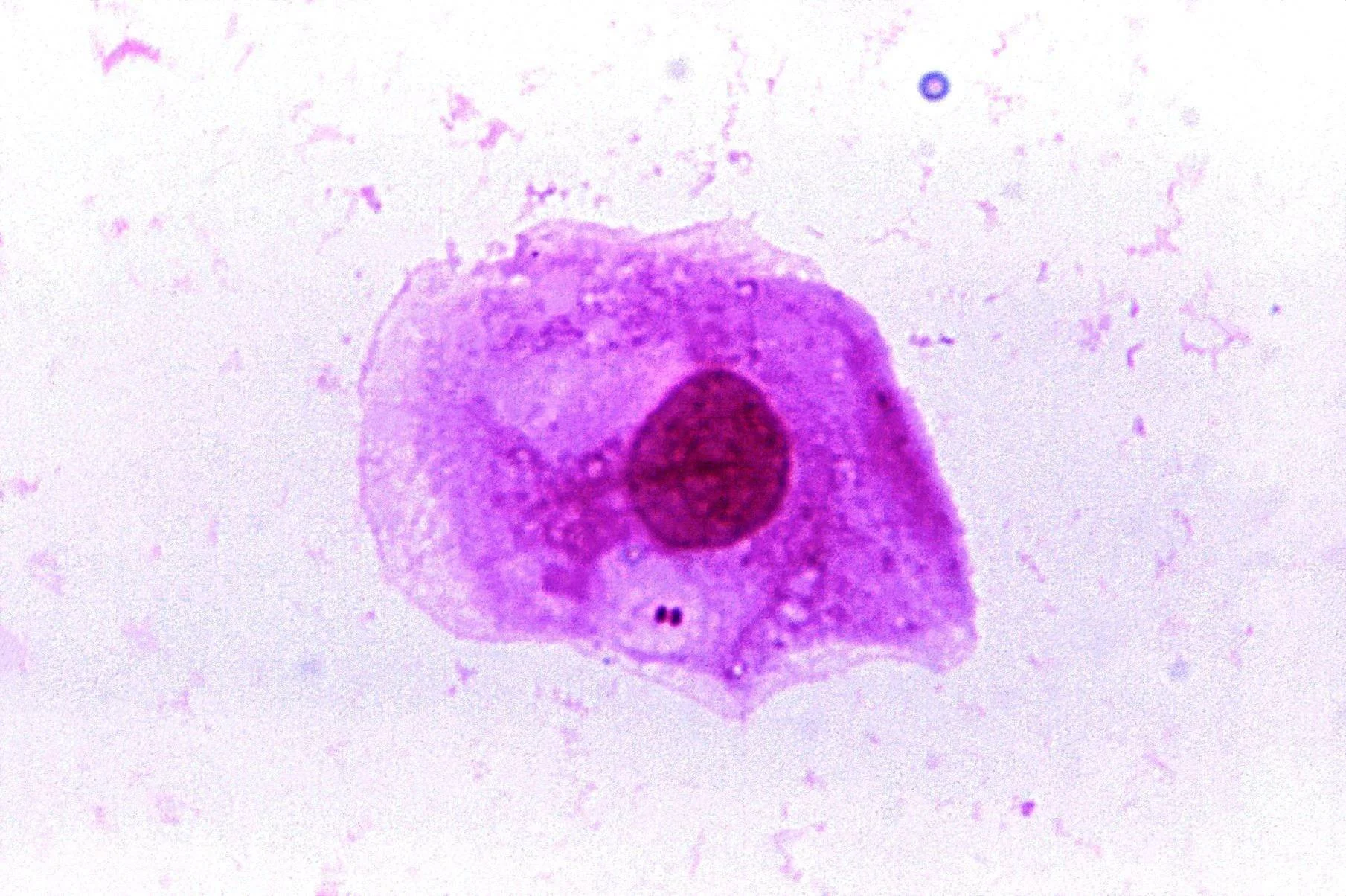 Micrografía óptica de una célula con núcleo prominente teñido en rojo intenso y citoplasma violeta expandido.