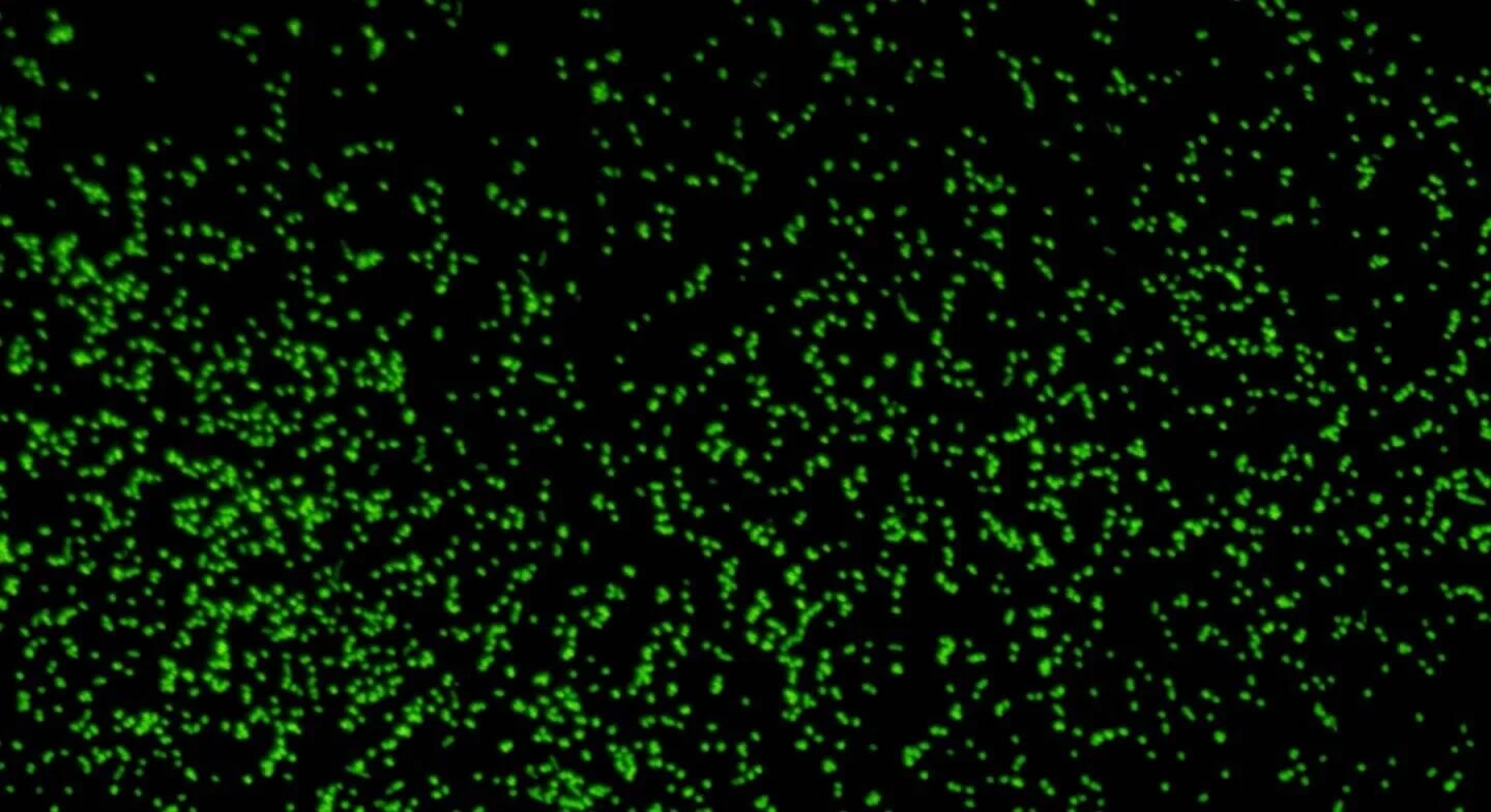 Micrografía de fluorescencia que muestra miles de bacterias teñidas en verde brillante sobre fondo negro.