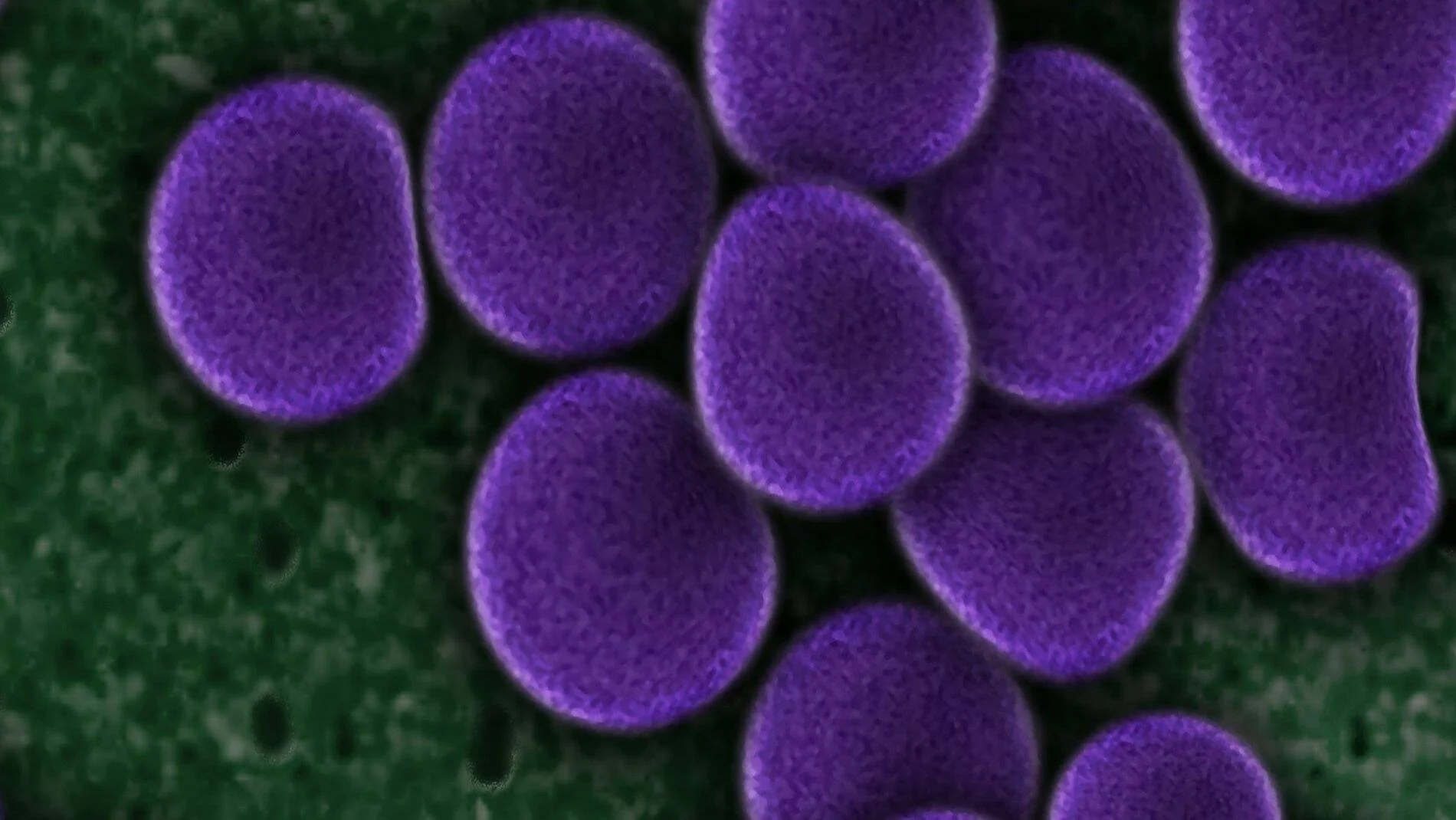 Imagen de microscopía electrónica coloreada que muestra bacterias cocáceas de color púrpura agrupadas sobre fondo verde.