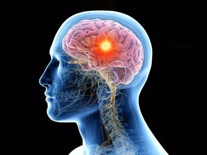 Modelo 3D de perfil humano con cerebro visible y un punto luminoso que indica actividad o lesión cerebral.